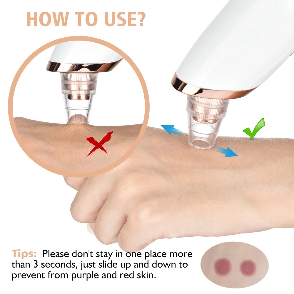 Blackhead Remover & Pore Cleaner Black Pimple Blemish Remover